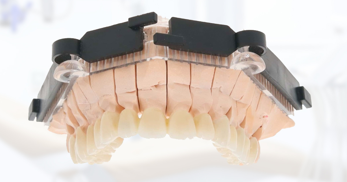Coroanele dentare din zirconiu – tipuri și beneficii