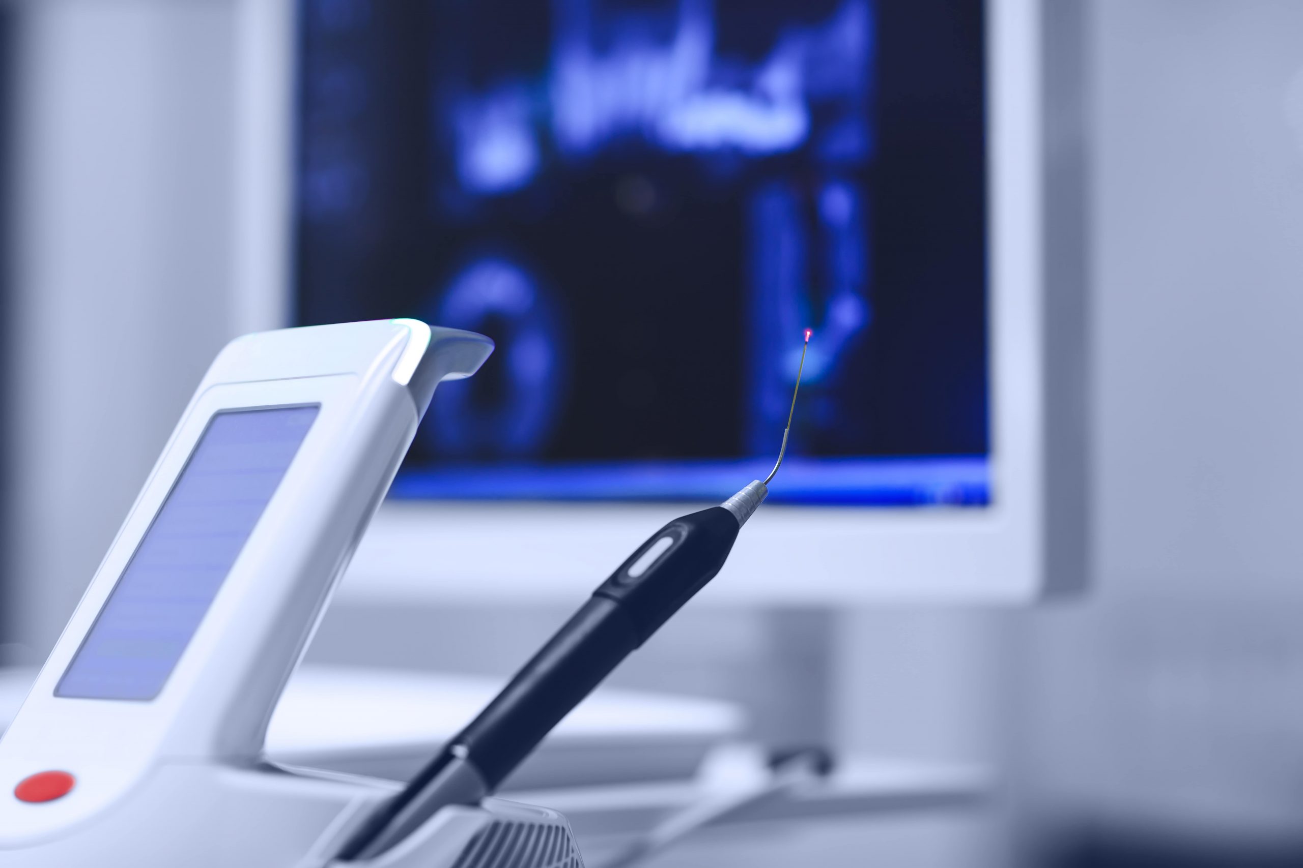 Laserul dentar – precizie și beneficii